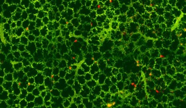 Visualization of resident megakaryocytes in the lungs. Image credit: Emma Lefrançais et al, doi: 10.1038/nature21706.