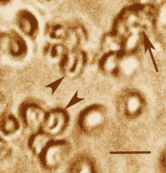 Two uninfected fossil mammalian erythrocytes (arrowheads), and one infected with Babesia-type pathogen Paleohaimatus calabresi (arrow). Scale bar - 10 µm. Image credit: George Poinar, Jr.