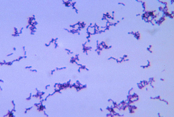 This micrograph depicts the gram-positive bacterium Propionibacterium acnes grown in thioglycollate medium at 48 hours. Propionibacterium acnes is a very common obligate anaerobic, non-spore forming rod, and the etiologic pathogen responsible for acne vulgaris, or pimples. It normally resides in the sebaceous glands of the skin. Image credit: Bobby Strong, CDC.