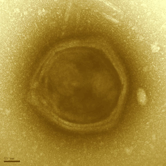 Transmission electron microscopy image of a candidate Klosneuvirus particle detected in the Klosterneuburg waste water treatment plant biomass. The particle exhibits features reminiscent of Mimiviridae including a faceted, multi-layered envelope surrounding a central core. Scale bar - 50 nm. Image credit: Schulz et al.