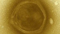 Transmission electron microscopy image of a candidate Klosneuvirus particle detected in the Klosterneuburg waste water treatment plant biomass. The particle exhibits features reminiscent of Mimiviridae including a faceted, multi-layered envelope surrounding a central core. Image credit: Schulz et al.