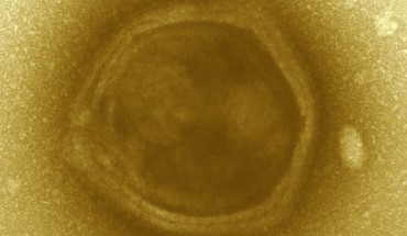 Transmission electron microscopy image of a candidate Klosneuvirus particle detected in the Klosterneuburg waste water treatment plant biomass. The particle exhibits features reminiscent of Mimiviridae including a faceted, multi-layered envelope surrounding a central core. Image credit: Schulz et al.