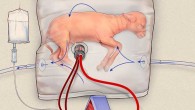 Most previous attempts at creating a womb-like device used artificial pumps to drive the blood through the system, causing heart failure. In the system invented by Partridge et al, the fetal heart is the only pump. It is different in other key ways. Use of the bag, rather than a more open container, nearly eliminated the infection issues that contributed to previous failures. And while previous attempts relied on blood vessels in the neck, the authors figured out how to quickly and successfully insert tubes (cannulas) into the notoriously touchy umbilical vessels. Image credit: Children’s Hospital of Philadelphia.