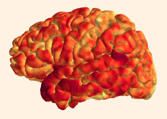 The thickness of the cerebral cortex is correlated with the epigenetic profile of immune-related genes. Image credit: University of Basel.