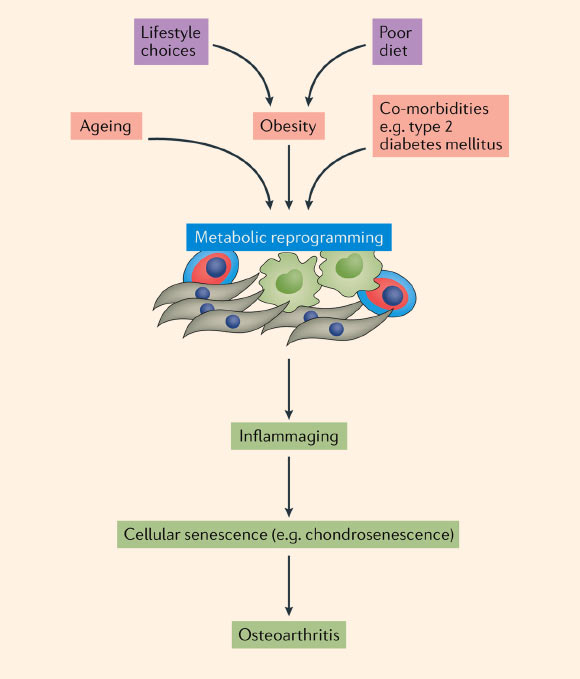 Factors underlying metabolic alterations in osteoarthritis: poor diet and lifestyle choices can contribute to weight gain and lead to obesity; ageing, obesity and other co-morbidities associated with osteoarthritis contribute to metabolic reprogramming in a variety of cells and tissues, leading to inflammaging and cellular senescence, which in turn cause further changes in cellular metabolism in osteoarthritis. Image credit: Mobasheri et al / Nature Reviews Rheumatology, doi: 10.1038/nrrheum.2017.50.