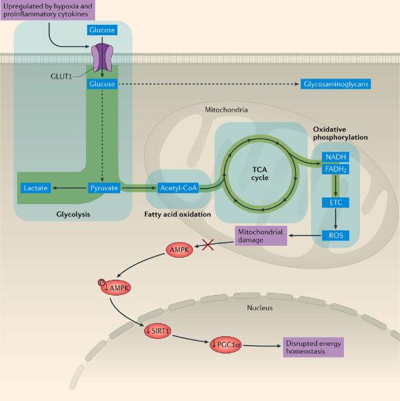 Altered metabolism in chondrocytes in osteoarthritis: chondrocytes in osteoarthritis switch from oxidative phosphorylation to glycolysis as their main source of energy metabolism; in osteoarthritic joints, chondrocytes are exposed to proinflammatory cytokines and microenvironmental alterations, including hypoxia and nutrient stress; mitochondrial metabolism is impaired and reactive oxygen species accumulate, causing damage to mitochondria which inhibits AMPK signaling and activity, downregulate SIRT1 and decrease levels of PGC1α, the master regulator of mitochondrial biogenesis. AMPK - AMP-activated protein kinase; ETC - electron transport chain; GLUT1 - glucose transporter type 1; PGC1α - peroxisome proliferator-activated receptor γ co-activator 1α; SIRT1 - NAD-dependent protein deacetylase sirtuin-1; TCA - tricarboxylic acid. Image credit: Mobasheri et al / Nature Reviews Rheumatology, doi: 10.1038/nrrheum.2017.50.