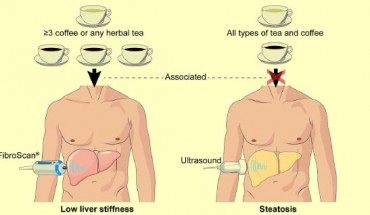 Alferink et al determined that regular coffee and herbal tea consumption was inversely related with liver stiffness, but not steatosis, in the general population. Image credit: Louise Alferink / Sarwa Darwish Murad.