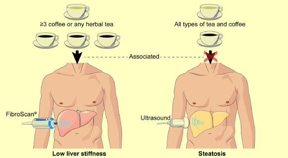 Alferink et al determined that regular coffee and herbal tea consumption was inversely related with liver stiffness, but not steatosis, in the general population. Image credit: Louise Alferink / Sarwa Darwish Murad.
