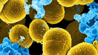 This digitally-colorized scanning electron microscopic (SEM) image depicts a number of mustard-colored, spheroid-shaped Staphylococcus aureus bacteria that were in the process of escaping their destruction by blue-colored human white blood cells. Magnification - 20,000x. Image credit: National Institute of Allergy and Infectious Diseases.