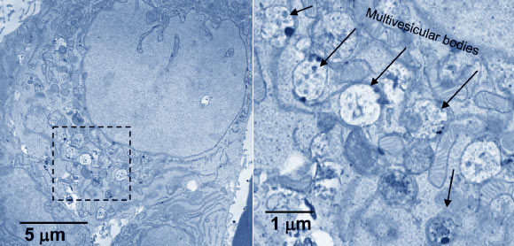 Electron microscopic images (false color) of hypothalamic neural stem/progenitor cells. Right - high magnification of the outlined area on the left; arrows indicate the presence of multivescular bodies. Image credit: Zhang et al, doi: 10.1038/nature23282.