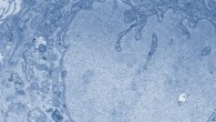 Electron microscopic images (false color) of hypothalamic neural stem/progenitor cells. Right - high magnification of the outlined area on the left; arrows indicate the presence of multivescular bodies. Image credit: Zhang et al, doi: 10.1038/nature23282.