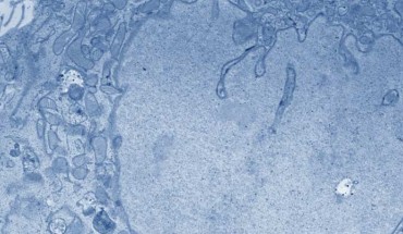 Electron microscopic images (false color) of hypothalamic neural stem/progenitor cells. Right - high magnification of the outlined area on the left; arrows indicate the presence of multivescular bodies. Image credit: Zhang et al, doi: 10.1038/nature23282.