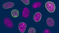Human cell nuclei with fluorescently labeled chromatin (purple) and nuclear envelope (green). Image credit: Fang-Yi Chu & Alexandra Zidovska, New York University.