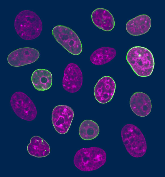 Human cell nuclei with fluorescently labeled chromatin (purple) and nuclear envelope (green). Image credit: Fang-Yi Chu & Alexandra Zidovska, New York University.