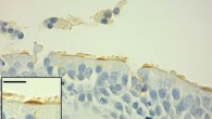 Immunohistochemical analysis of a human lung section stained with anti-PIWIL4 antibody. Scale bars - 10 μm. Image credit: Wasserman et al, doi: 10.1172/JCI94639.