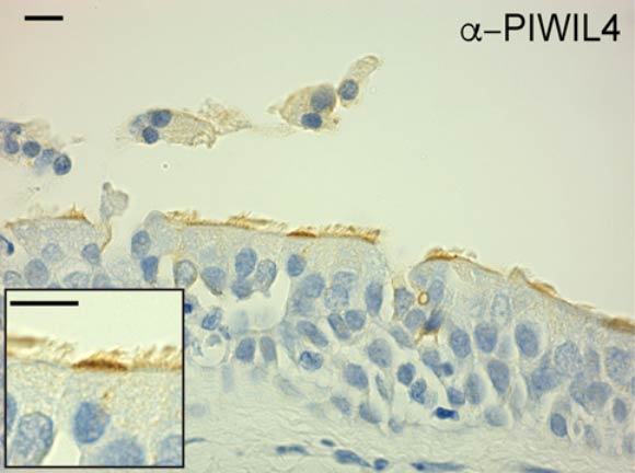 Immunohistochemical analysis of a human lung section stained with anti-PIWIL4 antibody. Scale bars - 10 μm. Image credit: Wasserman et al, doi: 10.1172/JCI94639.