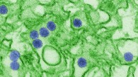 This is a digitally-colorized transmission electron microscopic (TEM) image of Zika virus. Virus particles, here colored blue, are 40 nm in diameter, with an outer envelope, and an inner dense core. Image credit: Cynthia Goldsmith, CDC.