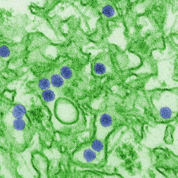 This is a digitally-colorized transmission electron microscopic (TEM) image of Zika virus. Virus particles, here colored blue, are 40 nm in diameter, with an outer envelope, and an inner dense core. Image credit: Cynthia Goldsmith, CDC.