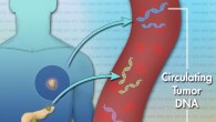 For the first time, researchers have used mutations detected in circulating tumor DNA drawn from patient blood to predict responses to immunotherapy, supporting the usage of this non-invasive diagnostic approach in the clinic. Image credit: National Human Genome Research Institute.