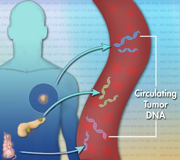 For the first time, researchers have used mutations detected in circulating tumor DNA drawn from patient blood to predict responses to immunotherapy, supporting the usage of this non-invasive diagnostic approach in the clinic. Image credit: National Human Genome Research Institute.