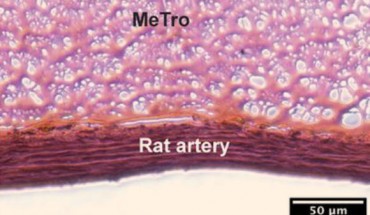 The surgical glue MeTro is applied directly to the wound and activated with light. Image credit: University of Sydney.