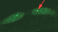 KLFs are a subfamily of zinc finger transcriptional regulators with highly characterized roles in proliferation, survival, metabolism, and response to stress. Hsieh et al demonstrate that KLFs are critical determinants of aging, influencing both lifespan and age-related deterioration, and are broadly required for lifespan extension in all four mechanistically distinct longevity models tested. Importantly, the team provides evidence that these effects are mediated by KLF regulation of autophagy (autophagy was assessed using a GFP::LGG-1 translational reporter; GFP-positive puncta [red arrow] were counted in 30-150 total hypodermal seam cells in 10–20 animals) and are conserved in a mammalian system via a functional ortholog, KLF4. Together, the findings provide a role for the KLFs as a transcriptional regulatory point in longevity. Image credit: Hsieh et al, doi: 10.1038/s41467-017-00899-5.