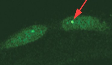KLFs are a subfamily of zinc finger transcriptional regulators with highly characterized roles in proliferation, survival, metabolism, and response to stress. Hsieh et al demonstrate that KLFs are critical determinants of aging, influencing both lifespan and age-related deterioration, and are broadly required for lifespan extension in all four mechanistically distinct longevity models tested. Importantly, the team provides evidence that these effects are mediated by KLF regulation of autophagy (autophagy was assessed using a GFP::LGG-1 translational reporter; GFP-positive puncta [red arrow] were counted in 30-150 total hypodermal seam cells in 10–20 animals) and are conserved in a mammalian system via a functional ortholog, KLF4. Together, the findings provide a role for the KLFs as a transcriptional regulatory point in longevity. Image credit: Hsieh et al, doi: 10.1038/s41467-017-00899-5.