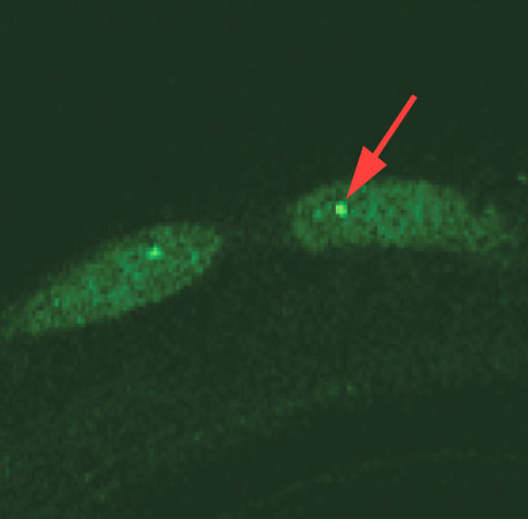 KLFs are a subfamily of zinc finger transcriptional regulators with highly characterized roles in proliferation, survival, metabolism, and response to stress. Hsieh et al demonstrate that KLFs are critical determinants of aging, influencing both lifespan and age-related deterioration, and are broadly required for lifespan extension in all four mechanistically distinct longevity models tested. Importantly, the team provides evidence that these effects are mediated by KLF regulation of autophagy (autophagy was assessed using a GFP::LGG-1 translational reporter; GFP-positive puncta [red arrow] were counted in 30-150 total hypodermal seam cells in 10–20 animals) and are conserved in a mammalian system via a functional ortholog, KLF4. Together, the findings provide a role for the KLFs as a transcriptional regulatory point in longevity. Image credit: Hsieh et al, doi: 10.1038/s41467-017-00899-5.