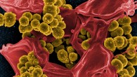 Scanning electron micrograph of methicillin-resistant Staphylococcus aureus. Image credit: National Institute of Allergy and Infectious Diseases.