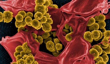 Scanning electron micrograph of methicillin-resistant Staphylococcus aureus. Image credit: National Institute of Allergy and Infectious Diseases.