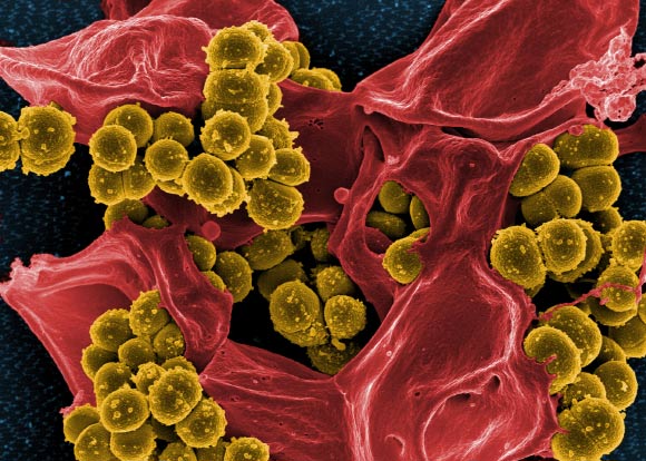 Scanning electron micrograph of methicillin-resistant Staphylococcus aureus. Image credit: National Institute of Allergy and Infectious Diseases.