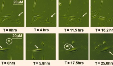 This is a 92 hour time capture image from senescent cultures of human fibroblasts (NHDF) treated with vehicle only controls (DMSO) and 92 hour time capture image showing NHDF cells treated with resveratrol. Image credit: University of Exeter.