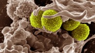 Teixobactin eliminates MRSA, Mycobacterium tuberculosis, Streptococcus pneumoniae, Bacillus anthracis and other dangerous pathogens without encountering any detectable resistance. This digitally-colorized, scanning electron microscopic image depicts green-colored, spheroid-shaped MRSA bacteria, as they were in the process of being enveloped by a much larger, human white blood cell. Image credit: National Institute of Allergy and Infectious Diseases.