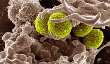 Teixobactin eliminates MRSA, Mycobacterium tuberculosis, Streptococcus pneumoniae, Bacillus anthracis and other dangerous pathogens without encountering any detectable resistance. This digitally-colorized, scanning electron microscopic image depicts green-colored, spheroid-shaped MRSA bacteria, as they were in the process of being enveloped by a much larger, human white blood cell. Image credit: National Institute of Allergy and Infectious Diseases.