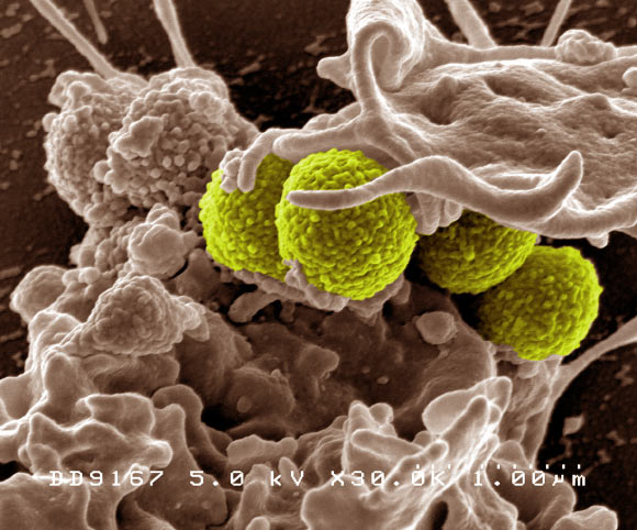 Teixobactin eliminates MRSA, Mycobacterium tuberculosis, Streptococcus pneumoniae, Bacillus anthracis and other dangerous pathogens without encountering any detectable resistance. This digitally-colorized, scanning electron microscopic image depicts green-colored, spheroid-shaped MRSA bacteria, as they were in the process of being enveloped by a much larger, human white blood cell. Image credit: National Institute of Allergy and Infectious Diseases.