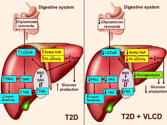 Perry et al show that three days of a VLCD lowered plasma glucose and insulin concentrations in a rat model of type 2 diabetes (T2D) without altering body weight. Image credit: Perry et al, doi: 10.1016/j.cmet.2017.10.004.