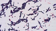Lactobacillus murinus. Image credit: RIKEN.