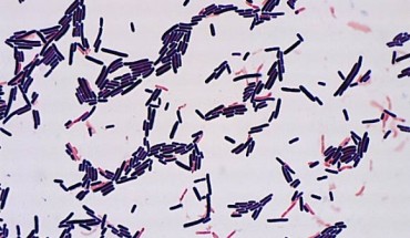 Lactobacillus murinus. Image credit: RIKEN.