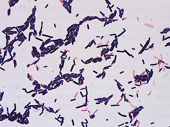 Lactobacillus murinus. Image credit: RIKEN.