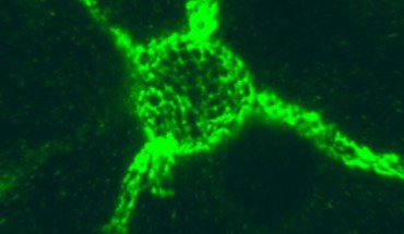 This image shows a perineuronal net (green) surrounding a neuron. Image credit: Kristian Lensjø.