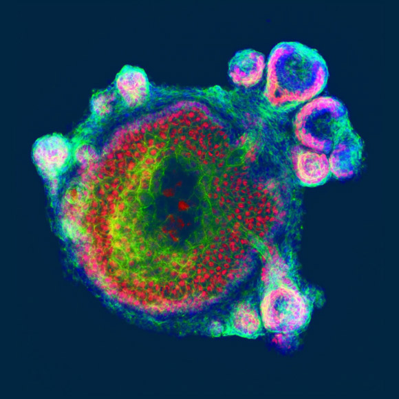In this artwork, hair follicles grow radially out of spherical skin organoids, which contain concentric epidermal and dermal layers (central structure). Skin organoids self-assemble and spontaneously generate many of the progenitor cells observed during normal development, including cells expressing the protein GATA3 in the hair follicles and epidermis (red). Image credit: Jiyoon Lee / Karl R. Koehler.