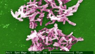 This digitally-colorized scanning electron microscopic image depicts a large grouping of rod-shaped Clostridium difficile. Image credit: Janice Carr & Lois S. Wiggs, CDC.