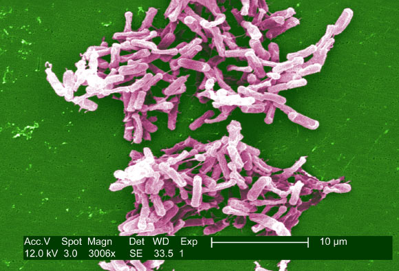 This digitally-colorized scanning electron microscopic image depicts a large grouping of rod-shaped Clostridium difficile. Image credit: Janice Carr & Lois S. Wiggs, CDC.
