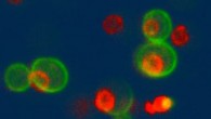 Yeast cells expressing proteins that carry green and red fluorescent tags to make them visible. Image credit: Brendan Ho.