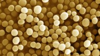 Research from the Rockefeller University suggests that variability between strains of the same bacterial species could influence patient immune response. Image credit: Mogana Das Murtey / Patchamuthu Ramasamy / CC BY-SA 3.