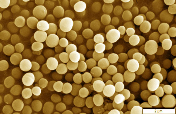 Research from the Rockefeller University suggests that variability between strains of the same bacterial species could influence patient immune response. Image credit: Mogana Das Murtey / Patchamuthu Ramasamy / CC BY-SA 3.