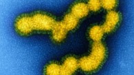 Colorized transmission electron micrograph of negatively stained SW31 (swine strain) influenza virus particles. Image credit: NIAID / CC BY 2.0.