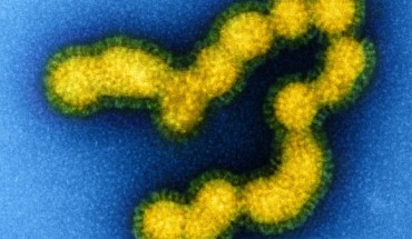 Colorized transmission electron micrograph of negatively stained SW31 (swine strain) influenza virus particles. Image credit: NIAID / CC BY 2.0.