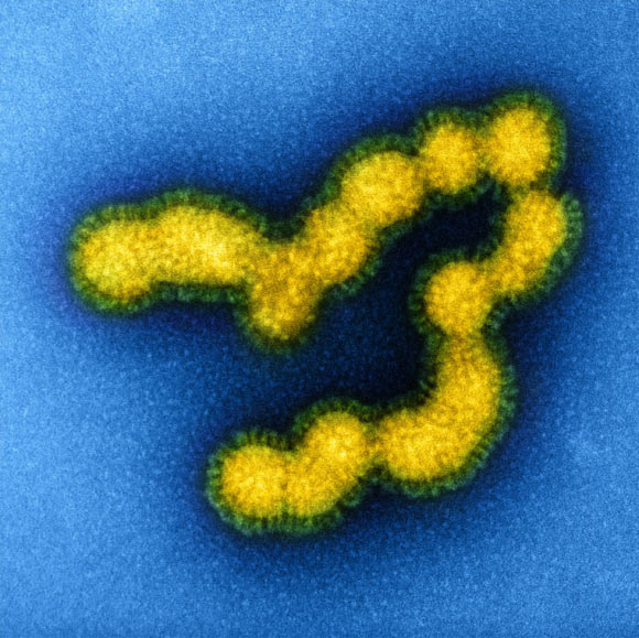 Colorized transmission electron micrograph of negatively stained SW31 (swine strain) influenza virus particles. Image credit: NIAID / CC BY 2.0.