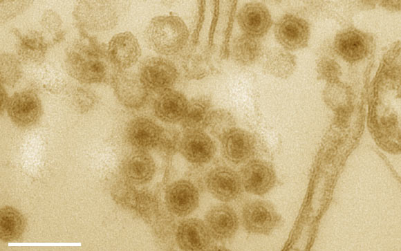 Thin-section electron microscopy of an agar overlay containing plaques of the representative Autolykiviridae virus 1.008.O; virus particles in contact with cell membranes are observed to occasionally possess tail-tube-like structures, whereas those not in contact with cells do not. Image credit: Kauffman et al, doi: 10.1038/nature25474.
